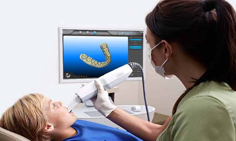 digital-impression-for-dentistry