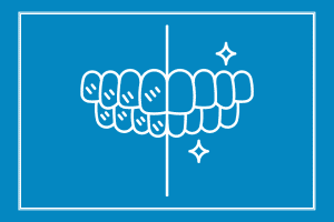 teeth whitening