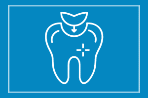 tooth fillings